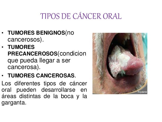 Causas De Dolor En La Lengua