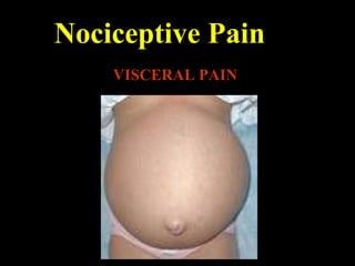 Nociceptive Pain
VISCERAL PAIN
 