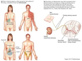 Figure 10-13: Referred pain
 