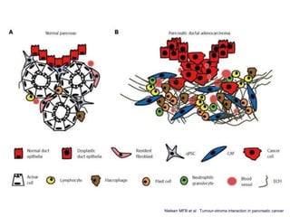 Nielsen MFB et al . Tumour-stroma interaction in pancreatic cancer
 