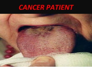 CANCER PATIENT 