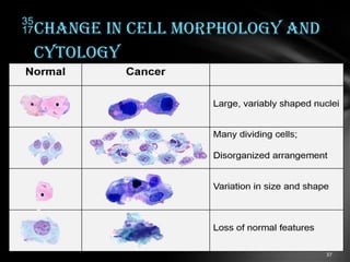 Development of cancer cells etiology, classification $ staging of ...