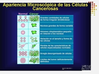 La Biopsia




Para diagnosticar la presencia de cáncer, el médico
tendrá que ver una muestra del tejido afectado
bajo un microscopio. Por lo tanto, cuando los
síntomas preliminares, la prueba de Papanicolaou,
el mamograma, la prueba de PSA o la prueba de
sangre oculta en heces (prueba FOBT) o
colonoscopia indican la posible existencia de
cáncer, el médico entonces tendrá que llevar a cabo
una biopsia, la cual consiste en la remoción
quirúrgica de una muestra pequeña del tejido para
su examen microscópico. (En el caso de las
leucemias, una muestra pequeña de sangre sirve
para el mismo propósito). Este examen
microscópico le indicará al médico si existe en
realidad un tumor, y si lo está, si es maligno
(cáncer) o benigno. Además, se pueden utilizar
microconjuntos para determinar cuáles genes se
activan o se desactivan en la muestra o se pueden
recolectar perfiles proteómicos para un análisis de
actividad de proteína. Esta información le ayudará a
los médicos a realizar un diagnóstico más preciso y
puede hasta ayudar a una planificación de
tratamiento más informado.
Bajo el microscopio el tejido canceroso se
caracteriza por su distintiva apariencia. Entre las
características que el médico busca están: un gran
número de células de forma irregular, dividiéndose,
la variación en el tamaño y la forma nuclear, la
variación en el tamaño y la forma de la célula, la
pérdida de las características especializadas de la
célula, la pérdida de la organización normal del
tejido y un límite externo mal definido del tumor.

 