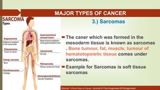 Sarcoma Example Cancer prevalence & causative agents 2018 | PPTX