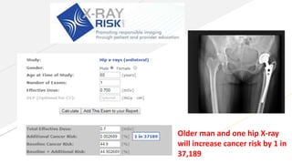 Cancer prevention aspec