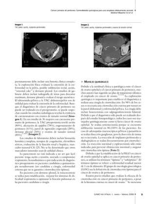 Cáncer primario de peritoneo. Generalidades quirúrgicas para una neoplasia relativamente reciente
Medina-Villaseñor EA et ...