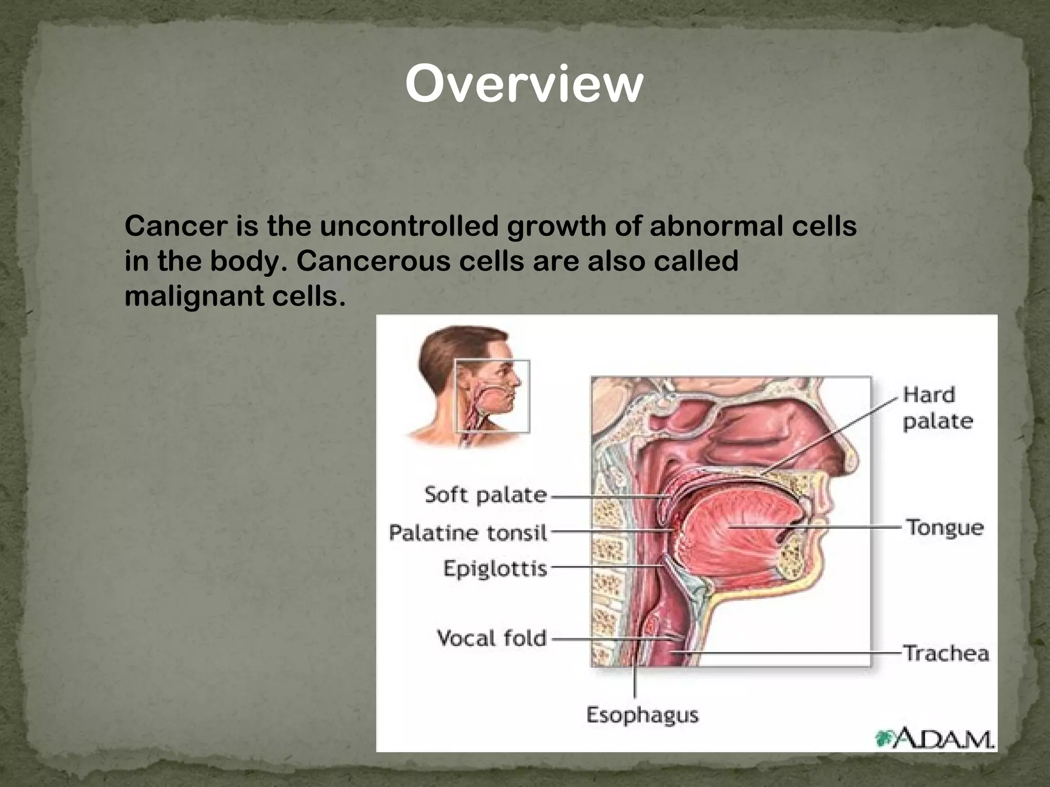 Overview

Cancer is the uncontrolled growth of abnormal cells
in the body. Cancerous cells are also called
malignant cells.
 