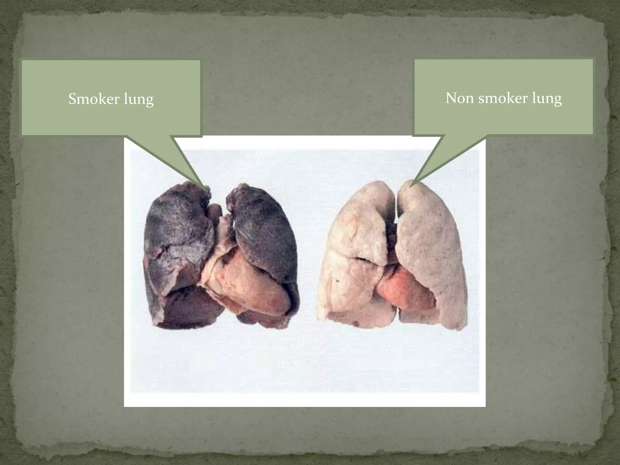 Smoker lung   Non smoker lung
 