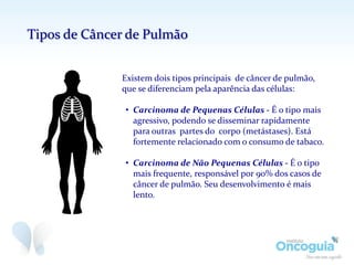 Existem dois tipos principais de câncer de pulmão,
que se diferenciam pela aparência das células:
• Carcinoma de Pequenas Células - É o tipo mais
agressivo, podendo se disseminar rapidamente
para outras partes do corpo (metástases). Está
fortemente relacionado com o consumo de tabaco.
• Carcinoma de Não Pequenas Células - É o tipo
mais frequente, responsável por 90% dos casos de
câncer de pulmão. Seu desenvolvimento é mais
lento.
Tipos de Câncer de Pulmão
 