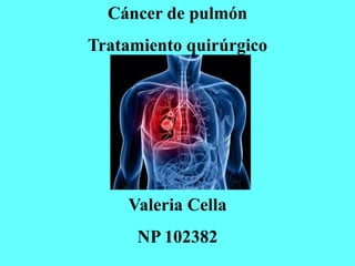 Cáncer de pulmón
Tratamiento quirúrgico




    Valeria Cella
      NP 102382
 