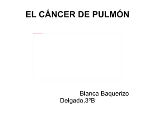 EL CÁNCER DE PULMÓN Blanca Baquerizo Delgado,3ºB 