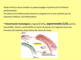 CANCER PULMON 2.pptx