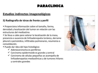 CANCER PULMON 2.pptx