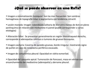 CANCER PULMON 2.pptx