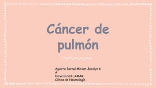 Cáncer de
pulmón
Aguirre Bernal Miriam Jocelyn 6
A
Universidad LAMAR
Clínica de Neumología
 