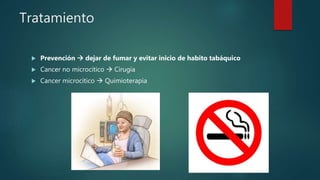 Tratamiento
 Prevención  dejar de fumar y evitar inicio de habito tabáquico
 Cancer no microcitico  Cirugía
 Cancer microcitico  Quimioterapia
 