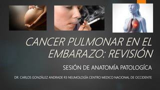 CANCER PULMONAR EN EL
EMBARAZO: REVISIÓN
SESIÓN DE ANATOMÍA PATOLOGÍCA
DR. CARLOS GONZÁLEZ ANDRADE R3 NEUMOLOGÍA CENTRO MEDICO NACIONAL DE OCCIDENTE
 