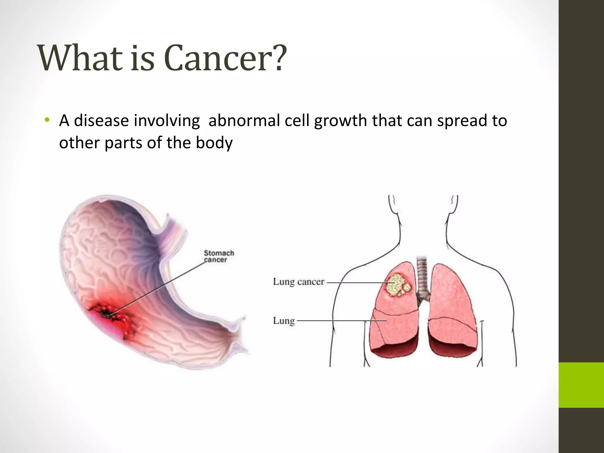 What is Cancer?
• A disease involving abnormal cell growth that can spread to
other parts of the body
 