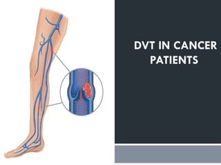 Dvt Cancer Rle Cancer related thrombosis and role of anticoagulants | PPTX