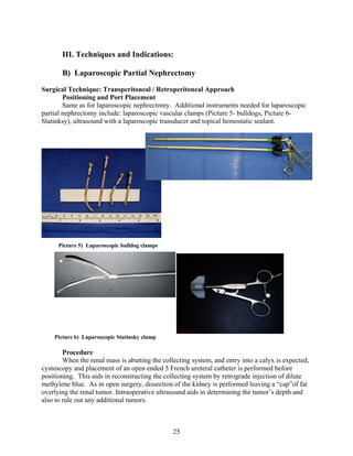 Nephrectomy Instrument Cancer renal | PDF
