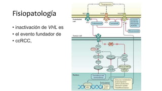 Fisiopatología
• inactivación de VHL es
• el evento fundador de
• ccRCC,
 