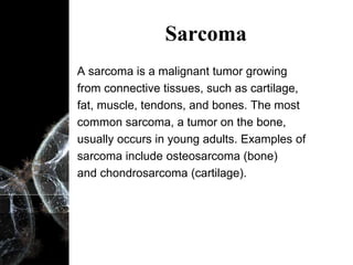 Sarcoma Example CANCER SeminarCancer Overview Type of Cancer.pptx