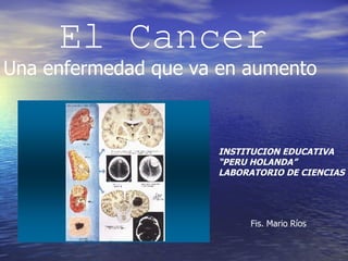 El Cancer Una enfermedad que va en aumento INSTITUCION EDUCATIVA  “ PERU HOLANDA” LABORATORIO DE CIENCIAS Fis. Mario Ríos 