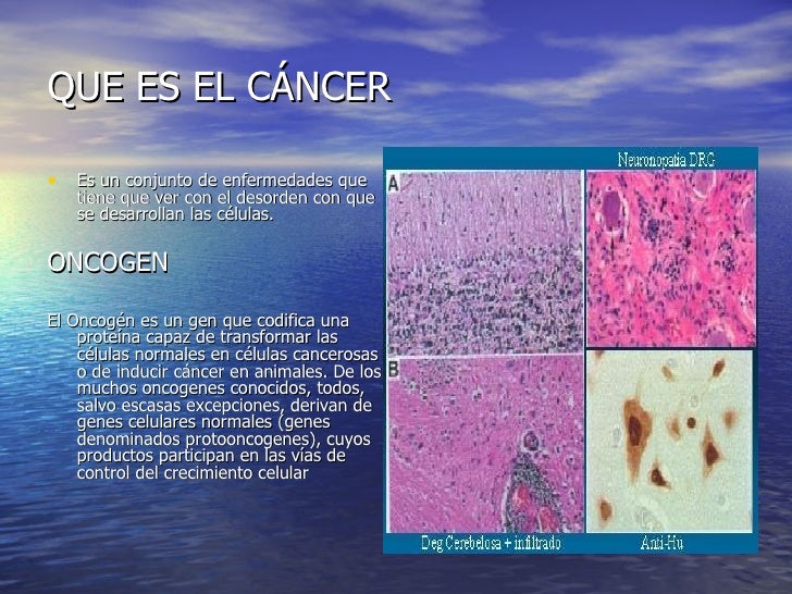 EL TEMA DEL CANCER