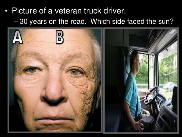 Image result for driver skin cancer