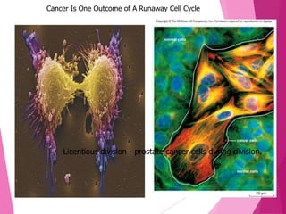 Cancer slides | PPTX
