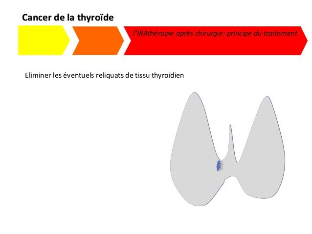 Cancers thyroïde cours IFSI 3ieme année