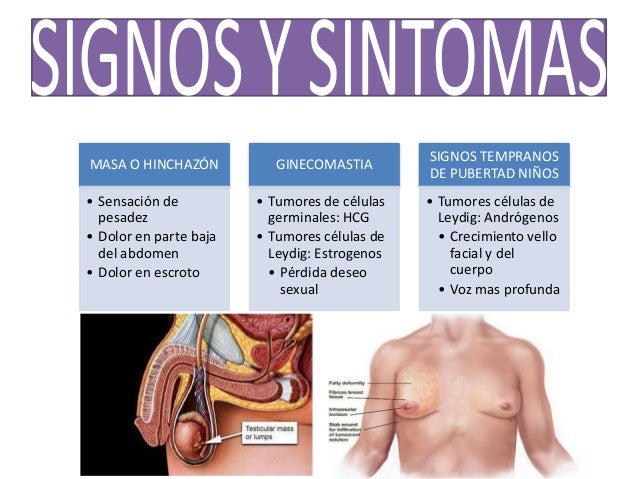 Cuál es el cáncer de colon más agresivo