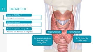 DIAGNÓSTICO
10
•La mayoría son eutiroideos
Niveles de TSH, T3 y T4
•Checar datos sugestivos de malignidad
Ultrasonido de cuello
•Pacientes con alto riesgo de malignidad.
Biopsia de aspiración con aguja fina
Hiperfuncional Hipofuncional
Considerado benigno
1% riesgo de
malignidad.
20% riesgo de
malignidad.
 