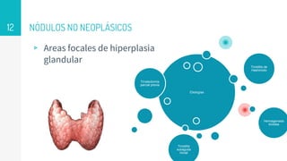NÓDULOS NO NEOPLÁSICOS
▹ Areas focales de hiperplasia
glandular
12
Etiologías
Tirodectomía
parcial previa
Tiroiditis de
Hashimoto
Hemiagenesis
tiroidea
Tiroiditis
subaguda
inicial
 