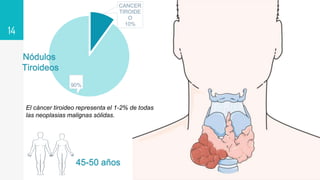 14
CANCER
TIROIDE
O
10%
90%
Nódulos
Tiroideos
El cáncer tiroideo representa el 1-2% de todas
las neoplasias malignas sólidas.
45-50 años
 