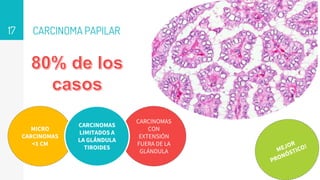 CARCINOMA PAPILAR
17
CARCINOMAS
CON
EXTENSIÓN
FUERA DE LA
GLÁNDULA
MICRO
CARCINOMAS
<1 CM
CARCINOMAS
LIMITADOS A
LA GLÁNDULA
TIROIDES
 