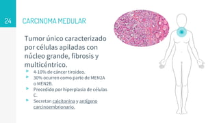 CARCINOMA MEDULAR
Tumor único caracterizado
por células apiladas con
núcleo grande, fibrosis y
multicéntrico.
▹ 4-10% de cáncer tiroideo.
▹ 30% ocurren como parte de MEN2A
o MEN2B.
▹ Precedido por hiperplasia de células
C.
▹ Secretan calcitonina y antígeno
carcinoembrionario.
24
 