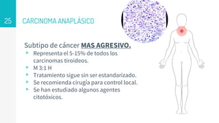 CARCINOMA ANAPLÁSICO
Subtipo de cáncer MAS AGRESIVO.
▹ Representa el 5-15% de todos los
carcinomas tiroideos.
▹ M 3:1 H
▹ Tratamiento sigue sin ser estandarizado.
▹ Se recomienda cirugía para control local.
▹ Se han estudiado algunos agentes
citotóxicos.
25
 