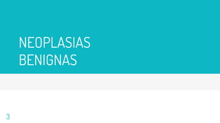 NEOPLASIAS
BENIGNAS
3
 