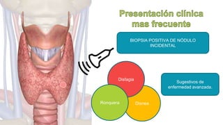 Disnea
33
BIOPSIA POSITIVA DE NÓDULO
INCIDENTAL
Disfagia
Ronquera
Sugestivos de
enfermedad avanzada.
 