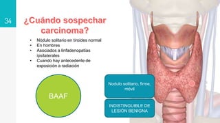 34
Nodulo solitario, firme,
móvil
INDISTINGUIBLE DE
LESIÓN BENIGNA
• Nódulo solitario en tiroides normal
• En hombres
• Asociados a linfadenopatías
ipsilaterales
• Cuando hay antecedente de
exposición a radiación
BAAF
 