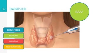 DIAGNÓSTICO
35
BAAF
RESULTADOS
BENIGNO
MALIGNO
INDETERMINADO
 