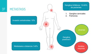 METASTASIS
37
Ganglios linfáticos: 12-64%
de pacientes
Invasión extratiroidea: 10%
Metástasis a distancia: 3-6%
1. Ganglios cervicales
2. Pulmones
Ganglios
positivos?
Jóvenes
Adultos
mayores
 