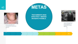 40
DEC
Casos avanzados con
necesidad de tratamiento
invasivo.
Cancer detectado por
ultrasonografía con
tratamiento menos
agresivo.
TRATAMIENTO MAS
EFECTIVO Y MENOS
INVASIVO POSIBLE.
 