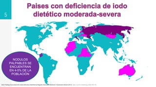 MAPS
5
Brain Findings Associated with Iodine Deficiency Identified by Magnetic Resonance Methods: A Systematic Review (2013). Open Journal of Radiology 3(04):180-195
NODULOS
PALPABLES SE
ENCUENTRAN
EN 4-5% DE LA
POBLACIÓN
 