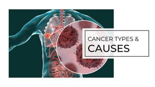 CANCER TYPES &
CAUSES
 