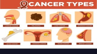 Types S Cancer Cancer types , spread , and it’s properties | PPTX