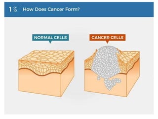 Cancer | PPTX