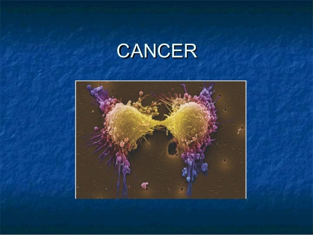 cancer ppt from mrs brenda lee