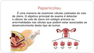 Papanicolau
É uma maneira de examinar células coletadas do colo
do útero. O objetivo principal do exame é detectar
o câncer de colo de útero em estágio precoce ou
anormalidades nas células que podem estar associadas ao
desenvolvimento deste tipo de tumor.
 